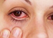 Causes of Eye Pain